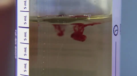 Blood drops Stock Footage 26096319