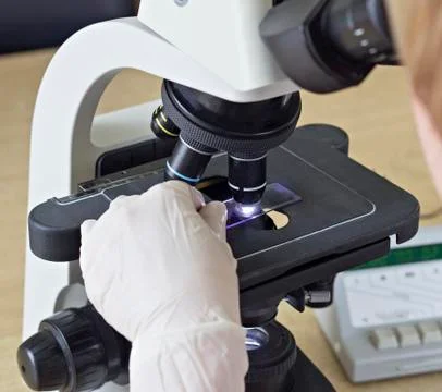 Blood examination through a microscope, close-up Photos