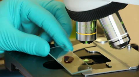 Blood expertise using microscope close up Stock Footage 63045701
