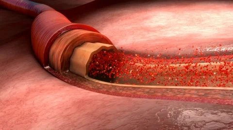 Blood flow in Heart Stock Footage 63030910