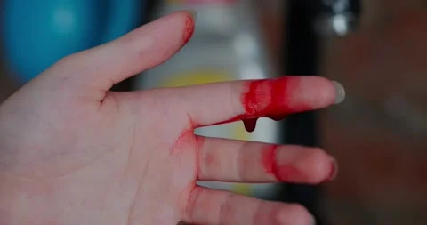 Blood flows from a finger Stock Footage 140235979