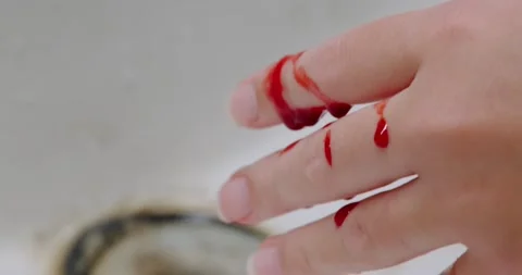 Blood flows from a finger Stock Footage 140235992