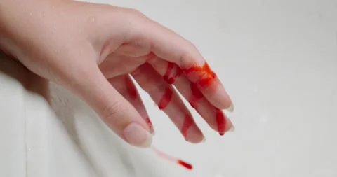Blood flows from a finger Stock Footage 140236004