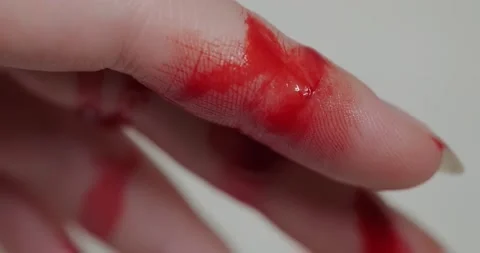 Blood flows from a finger Stock Footage 140236040