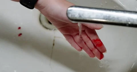 Blood flows from a finger Stock Footage 140236101