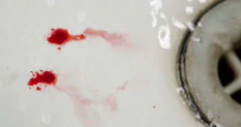 Blood flows from a finger 스톡 동영상 140236106