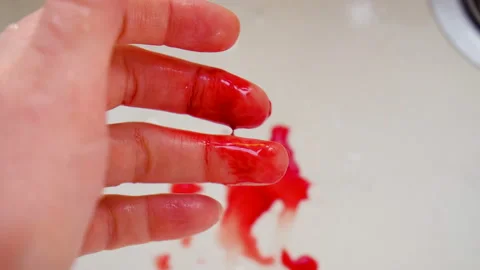 Blood flows from the hand of the finger. Selective focus. Stock Footage 235483540