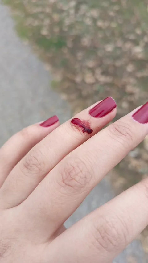 Blood flows from the wound down the womans finger. The woman cut herself with Stock Footage 318356583