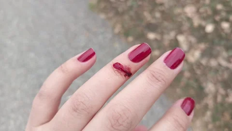 Blood flows from the wound down the womans finger. The woman cut herself with Stock Footage 318356613