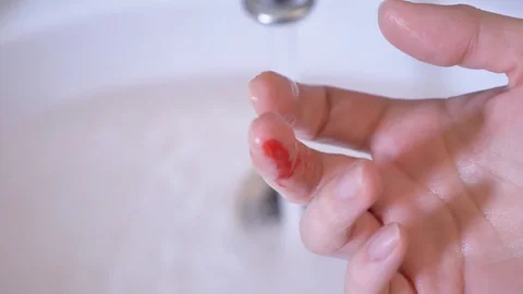 Blood flows from a wound on the middle finger of a woman. 4k Stock Footage 87929698