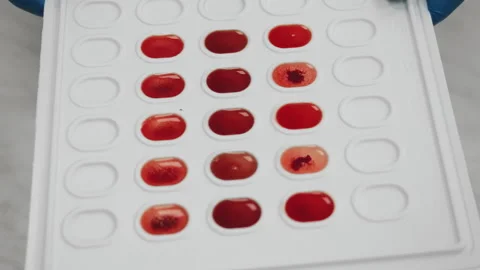 Blood group test samples on plastic palette in medical laboratory. Vídeos de archivo 320886328
