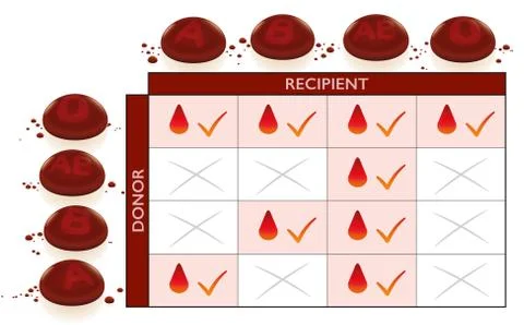 Blood Groups Universal Donor Recipient Transfusion Chart Stock Illustration