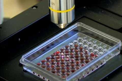 Blood microscope Stock Footage 98978