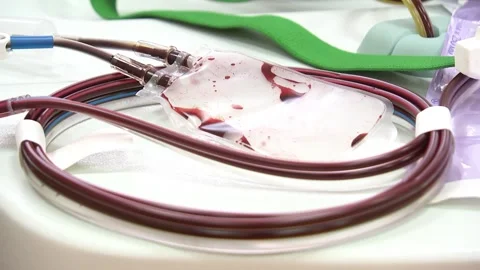 Blood modern transfusion machine. Pumping blood. Stock Footage 148366149