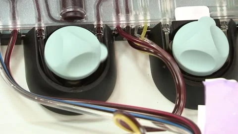 Blood modern transfusion machine. Pumping blood. Stock Footage 148904118