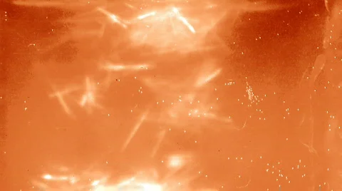 Blood Obstruction  Video stock 285634