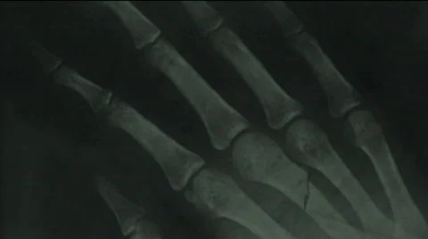 Blood over bones - digital animation Vidéo 459599