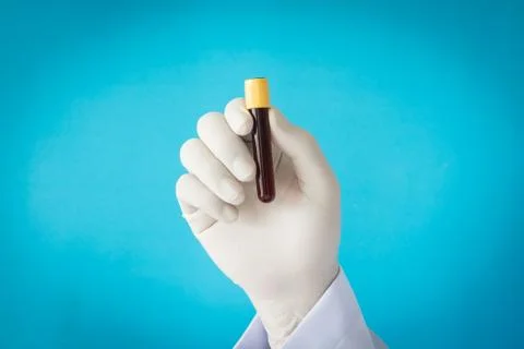 Blood Stock Photos