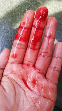 Blood Stock Photos