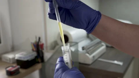 Blood plasma separation in test tubes Stock Footage 228989843
