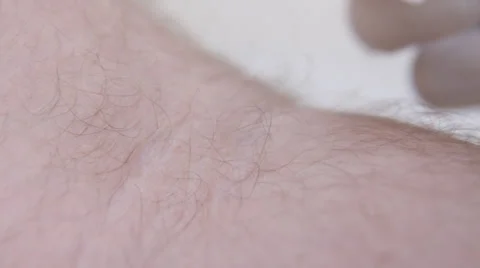 Blood prep and draw close-up Video stock 26094881