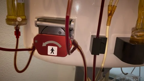 Blood purification method Transfusion Tubing And Flow Markers During Stock Footage 324871214