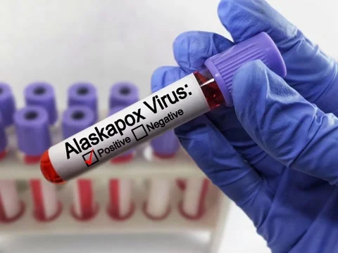 Blood sample of the Alaskapox virus. Virus, epidemic, disease.  Stock Footage 295129112