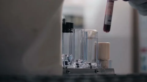 Blood sample analysed Stockbeeldmateriaal 130693914