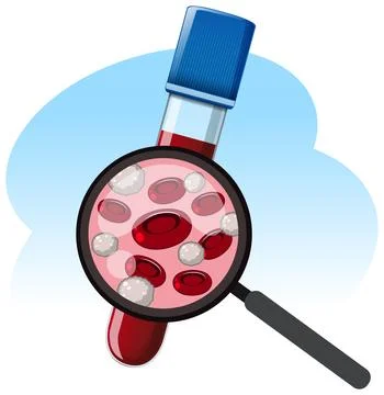 Blood Sample Analysis with Magnifying Glass Illustration Stock Illustration