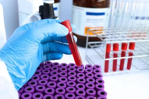 Blood sample to analyze in the laboratory Stockfoto's