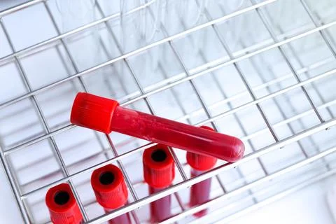 Blood sample to analyze in the laboratory Stockfoto's
