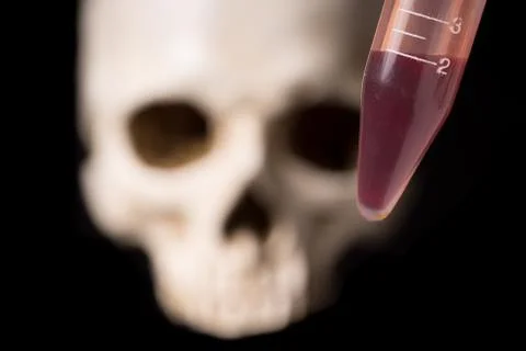 Blood sample and skull Stock Photos