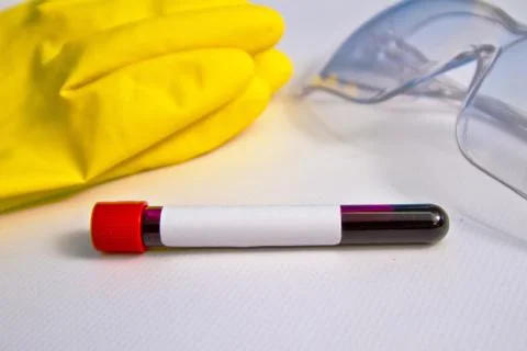 Blood sample on the background of rubber gloves and glasses on the table. Cov Stock Photos