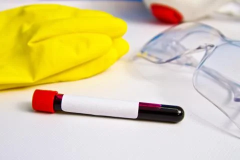 Blood sample on the background of rubber gloves and glasses on the table. Cov Stock Photos