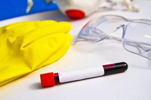Blood sample on the background of rubber gloves and glasses on the table. Cov Stock Photos