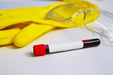 Blood sample on the background of rubber gloves and glasses on the table. Cov Stock Photos