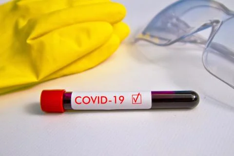 Blood sample on the background of rubber gloves and glasses on the table. The Stock Photos