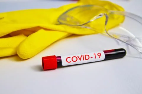 Blood sample on the background of rubber gloves and glasses on the table. The Stock Photos