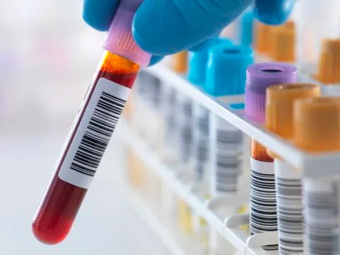 A blood sample being held with a row of human samples for analytical testing 库存照片