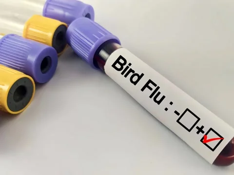 Blood sample with Bird Flu positive Stock Footage 304620543