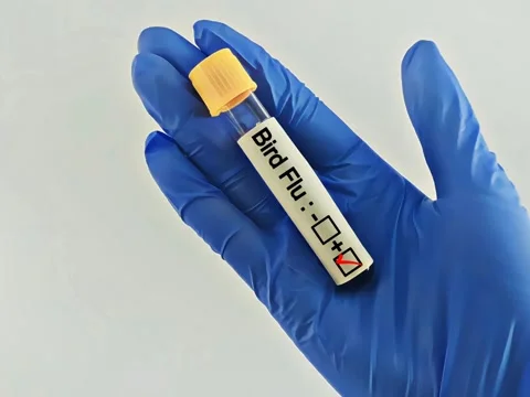 Blood sample with Bird Flu positive Stock Footage 304620588