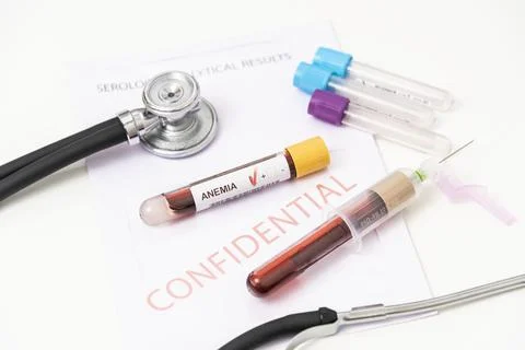 Blood sample for blood group testing Anemia. Stock Photos