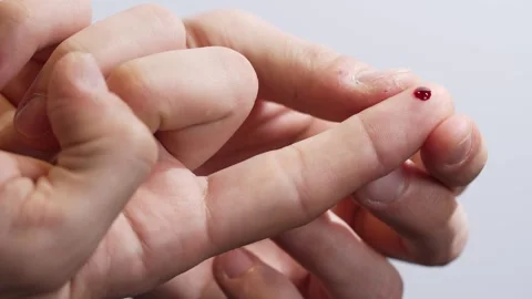Blood Sample Collection on Finger Stock Footage 312473781