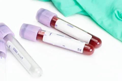 Blood Sample Collection Stock Photos