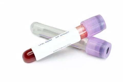 Blood Sample Collection Stock Photos