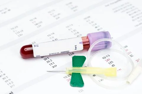 Blood Sample Collection Stock Photos