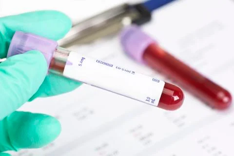 Blood Sample Collection Stock Photos