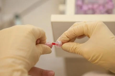 Blood Sample Finger Stock Photos