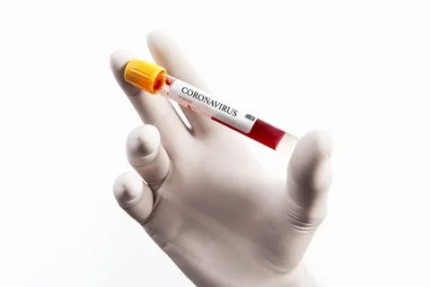 Blood Sample in a flask for analyzing Corona virus and producing vaccine. Corona Stock Photos