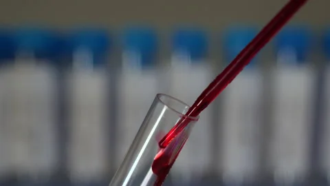Blood sample inserted into vial. Close up. Stock Footage 147944723